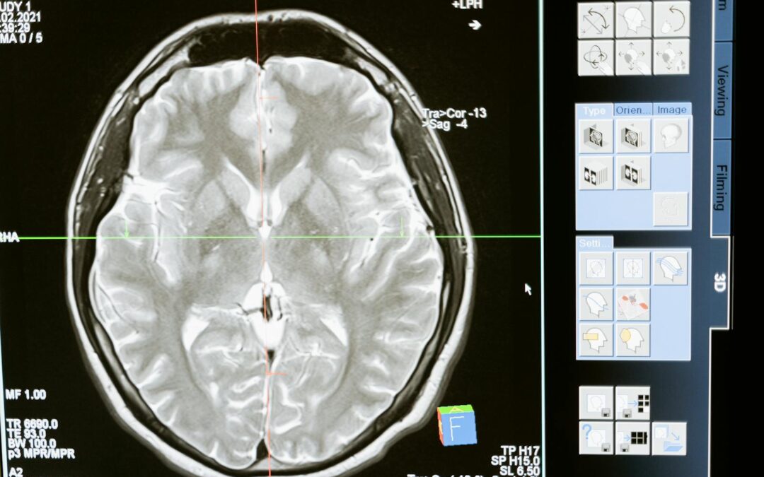 Healthy Living for Your Brain and Body